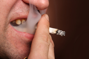 陶瓷牙會蛀牙嗎？瞭解真相，保護牙齒健康